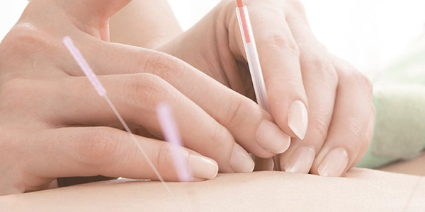 Traditional Chinese Medicine
